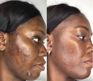 Real Results!
